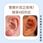 怎麼知道寶寶外耳正常嗎