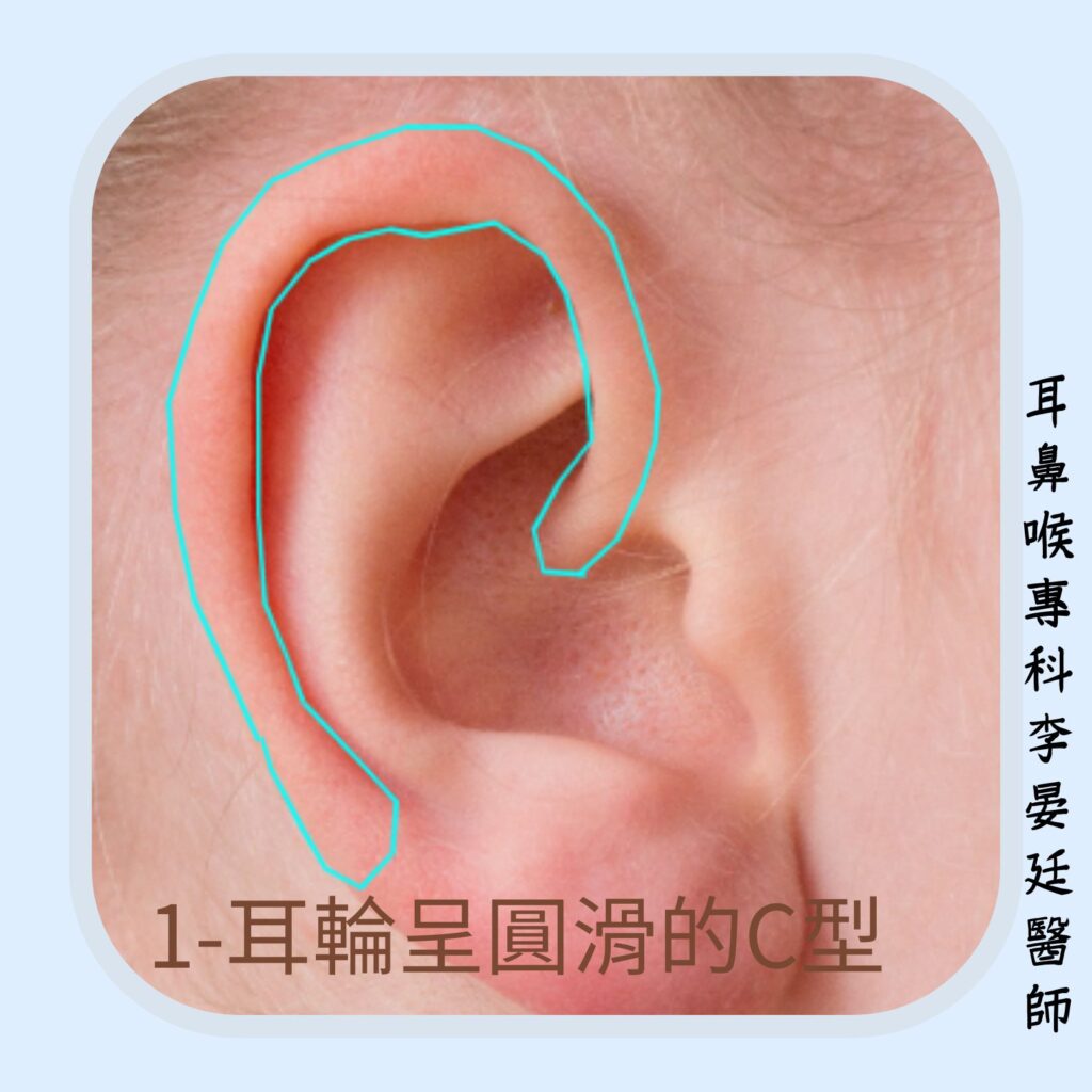 耳輪應呈圓滑的C型