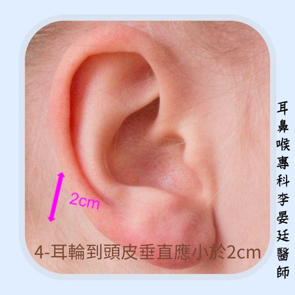 耳輪離頭皮垂直距離應小於2公分