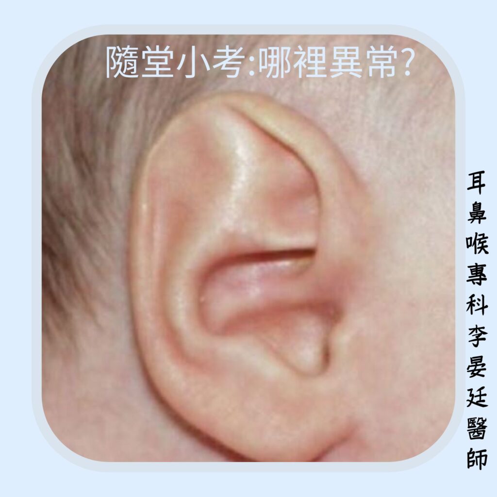 外耳形變的判定: 答案在文末 外耳形變的判定: 答案在文末